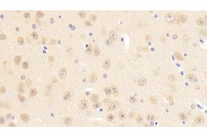 Detection of PCDHb2 in Mouse Cerebrum Tissue using Polyclonal Antibody to Protocadherin Beta 2 (PCDHb2) (PCDHb2 抗体  (AA 79-253))