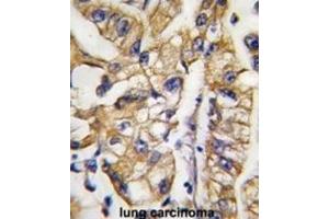 Immunohistochemistry (IHC) image for anti-SLC2A4 Regulator (SLC2A4RG) antibody (ABIN2997830) (SLC2A4RG 抗体)