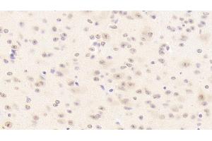 Detection of LRRC32 in Mouse Cerebellum Tissue using Polyclonal Antibody to Leucine Rich Repeat Containing Protein 32 (LRRC32) (LRRC32 抗体  (AA 400-643))