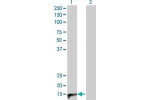 Western Blot analysis of CALCA expression in transfected 293T cell line by CALCA monoclonal antibody (M01), clone 4B10. (CGRP 抗体  (AA 52-141))