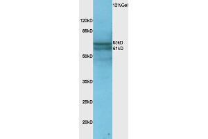 Rat lung lysate probed with Anti Phospho-NFKB p65(Ser276) Polyclonal Antibody, Unconjugated  at 1:3000 for 90 min at 37˚C. (NF-kB p65 抗体  (pSer276))
