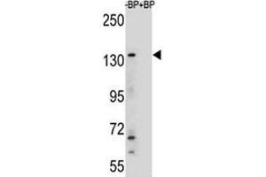 Western blot analysis of JMJD3 antibody and HeLa lysate (Kdm6b 抗体  (AA 954-987))