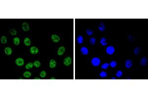 HepG2 cells were stained with Cyclin E1 (4H7) Monoclonal Antibody  at [1:200] incubated overnight at 4C, followed by secondary antibody incubation, DAPI staining of the nuclei and detection. (Cyclin E1 抗体)
