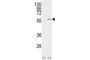 Western blot analysis of Vimentin antibody and 293 cell lysate (2 ug/lane) either nontransfected (Lane 1) or transiently transfected with the VIM gene (2).