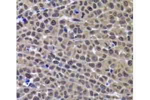 Immunohistochemistry of paraffin-embedded Mouse cancer using GPS1 Polyclonal Antibody at dilution of 1:100 (40x lens).