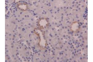 IHC-P analysis of Rat Kidney Tissue, with DAB staining. (KRT6A 抗体  (AA 323-461))