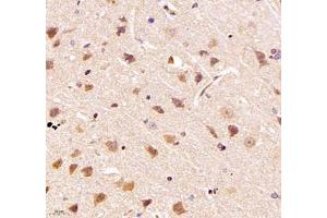 Immunohistochemistry of paraffin embedded rat brain using TYW1B (ABIN7076025) at dilution of 1: 700 (400x lens)
