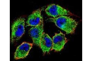 Confocal immunofluorescent analysis of A375 cells using NKD2  Antibody (C-term), followed by Alexa Fluor 488-conjugated goat anti-rabbit lgG (green). (NKD2 抗体  (C-Term))