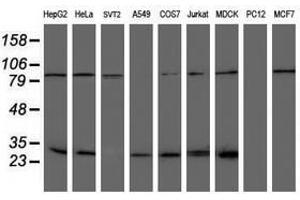 Image no. 8 for anti-NQO2 (NQO2) antibody (ABIN1499816) (NQO2 抗体)