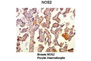 Immunohistochemistry (IHC) image for anti-Nitric Oxide Synthase 2, Inducible (NOS2) (N-Term) antibody (ABIN2789330)