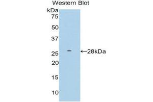 Western Blotting (WB) image for anti-Farnesyl-Diphosphate Farnesyltransferase 1 (FDFT1) (AA 187-416) antibody (ABIN3206186) (FDFT1 抗体  (AA 187-416))