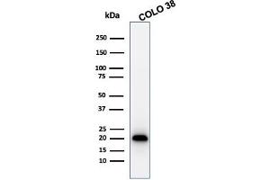 Western Blot Analysis of COLO 38 cell lysate using MART-1 Rabbit Recombinant Monoclonal Antibody (MLANA/1761R). (Recombinant MLANA 抗体)