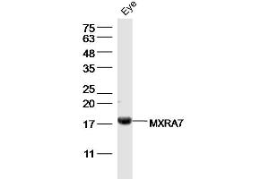 Mouse eye lysates probed with MXRA7 Polyclonal Antibody, Unconjugated  at 1:300 dilution and 4˚C overnight incubation. (MXRA7 抗体  (AA 121-204))