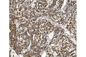 IHC analysis of BCKDHA using anti-BCKDHA antibody (ABIN7601223).