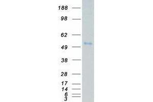 Western Blotting (WB) image for Vaccinia Related Kinase 3 (VRK3) (Transcript Variant 1) protein (Myc-DYKDDDDK Tag) (ABIN2735438)