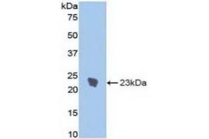 Western Blotting (WB) image for anti-Interleukin 1 Receptor, Type I (IL1R1) (AA 386-553) antibody (ABIN7437959)