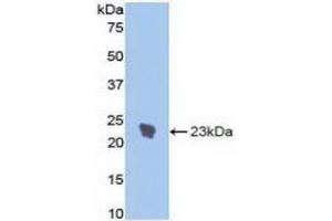 Detection of Recombinant IL1R1, Rat using Polyclonal Antibody to Interleukin 1 Receptor Type I (IL1R1) (IL1R1 抗体  (AA 386-553))