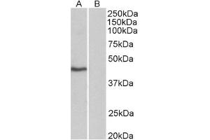 Image no. 1 for anti-TATA Box Binding Protein (TBP) (AA 2-12) antibody (ABIN1104605) (TBP 抗体  (AA 2-12))