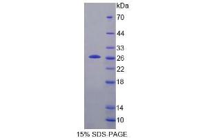SDS-PAGE analysis of Mouse TPT1 Protein. (TPT1 蛋白)