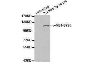 Western blot analysis of extracts of 293 cell line, using phospho-RB-S795 antibody (ABIN5969932). (Retinoblastoma 1 抗体  (pSer795))