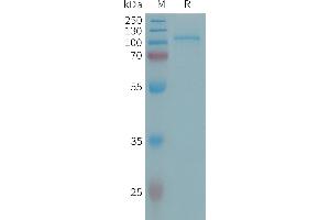 SDS-PAGE (SDS) image for Ectonucleotide Pyrophosphatase / phosphodiesterase 2 (ENPP2) (AA 49-863) protein (His tag) (ABIN7538220)