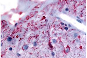 Human Eye, Ganglion Cells (formalin-fixed, paraffin-embedded) stained with GRM6 antibody ABIN213492 at 5. (Metabotropic Glutamate Receptor 6 抗体  (N-Term))
