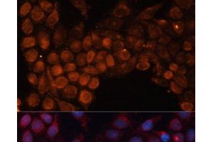 Immunofluorescence (IF) image for anti-Solute Carrier Family 25 (Mitochondrial Carrier, Phosphate Carrier), Member 24 (SLC25A24) antibody (ABIN7255936)