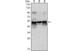 Western blot analysis using GFAP mouse mAb against A431 (1), SK-N-SH (2) and PC12 (3) cell lysate. (GFAP 抗体)