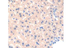 Immunohistochemistry (IHC) image for anti-Acetyl-CoA Acyltransferase 1 (ACAA1) (AA 182-424) antibody (ABIN5013058)