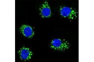 Confocal immunofluorescent analysis of MUSK antibody with MDA-MB231 cells followed by Alexa Fluor 488-conjugated goat anti-rabbit lgG (green). (MUSK 抗体)