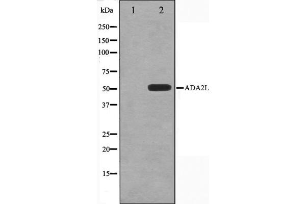 TADA2L Antikörper