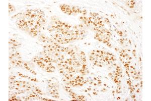 anti-RAD23 Homolog B (RAD23B) (AA 359-409) antibody