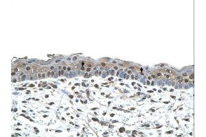 CENPA antibody was used for immunohistochemistry at a concentration of 4-8 ug/ml. (CENPA 抗体  (N-Term))