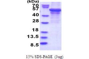 SDS-PAGE (SDS) image for Perilipin 2 (PLIN2) (AA 1-437) protein (T7 tag) (ABIN5853721) (ADRP Protein (AA 1-437) (T7 tag))