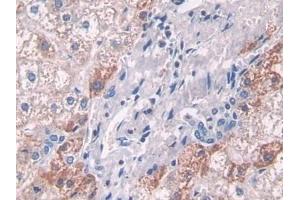 Immunohistochemistry (IHC) image for anti-ATPase, H+ Transporting, Lysosomal Accessory Protein 2 (ATP6AP2) (AA 17-302) antibody (ABIN7439744)