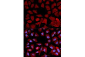 Immunofluorescence analysis of U2OS cells using PSMC4 antibody. (PSMC4 抗体  (AA 1-165))