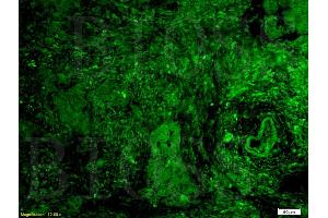 Immunofluorescence (IF) image for anti-G Protein-Coupled Estrogen Receptor 1 (GPER) (AA 251-375) antibody (ABIN685717)