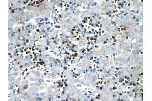 SCD antibody was used for immunohistochemistry at a concentration of 4-8 ug/ml to stain Hepatocytes (arrows) in Human liver. (SCD 抗体)
