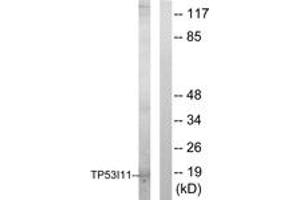 Western blot analysis of extracts from HuvEc cells, using TP53I11 Antibody. (TP53I11 抗体  (AA 71-120))