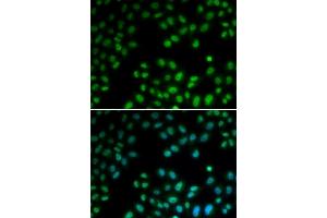 Immunofluorescence analysis of U2OS cells using PI antibody (ABIN6128449, ABIN6145593, ABIN6145595 and ABIN6221396). (PIAS1 抗体  (AA 422-651))