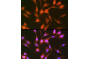 Immunofluorescence (IF) image for anti-Proteasome (Prosome, Macropain) 26S Subunit, Non-ATPase, 14 (PSMD14) antibody (ABIN7269588)