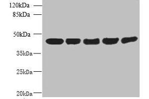 Western blot All lanes: ACTRT3 antibody at 2. (ARPM1 抗体  (AA 1-372))