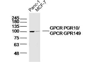 Lane 1: panc-1 lysates Lane 2: MCF-7 lysates probed with GPCR PGR10/GPCR GPR149 Polyclonal Antibody, Unconjugated  at 1:300 dilution and 4˚C overnight incubation. (GPR149 抗体  (AA 1-100))