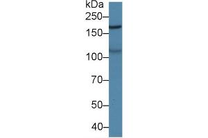 Detection of MAST2 in Porcine Cerebrum lysate using Polyclonal Antibody to Microtubule Associated Serine/Threonine Kinase 2 (MAST2)