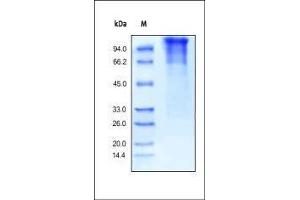 Human LDL R, His Tag on SDS-PAGE under reducing (R) condition. (LDLR Protein (AA 22-788) (His tag))