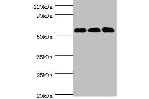 Western blot All lanes: XIAP antibody at 3 μg/mL Lane 1: HepG2 whole cell lysate Lane 2: MCF-7 whole cell lysate Lane 3: PC-3 whole cell lysate Secondary Goat polyclonal to rabbit IgG at 1/10000 dilution Predicted band size: 57 kDa Observed band size: 57 kDa (XIAP 抗体  (AA 1-200))