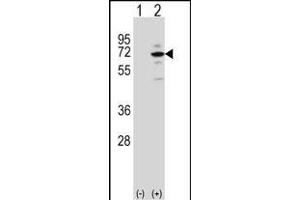 Western blot analysis of MeCP2 (arrow) using rabbit polyclonal MeCP2 Antibody (E11) (ABIN650708 and ABIN2839305). (MECP2 抗体  (N-Term))