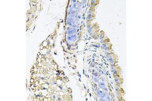 Immunohistochemistry of paraffin-embedded mouse lung using CTSK antibody (ABIN5970899) at dilution of 1/100 (40x lens). (Cathepsin K 抗体)