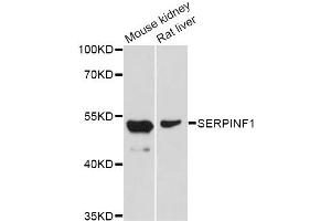 Western blot analysis of extracts of various cell lines, using SERPINF1 Antibody (ABIN5998782) at 1/1000 dilution. (PEDF 抗体)