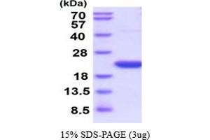 SDS-PAGE (SDS) image for Peptidylprolyl Isomerase F (PPIF) (AA 30-206) (Active) protein (His tag) (ABIN6387945) (PPIF Protein (AA 30-206) (His tag))
